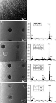 Effect of titanium implants along with silver ions and tetracycline on type I interferon-beta expression during implant-related infections in co-culture and mouse model